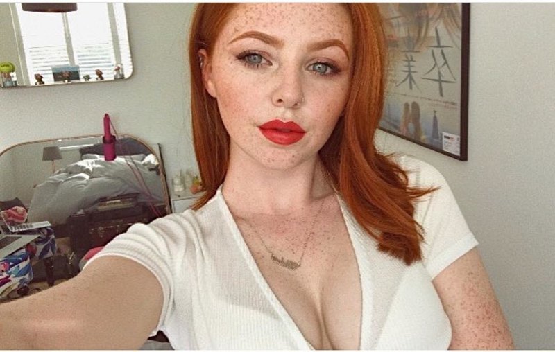 Girls With Freckles (20 pics)
