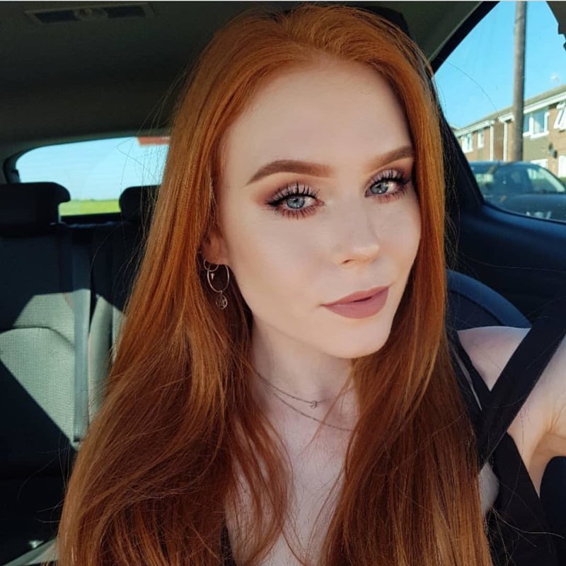 Girls With Freckles (20 pics)