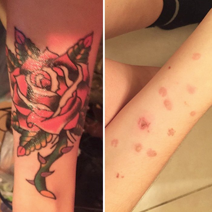 Cool Scar Cover (23 pics)