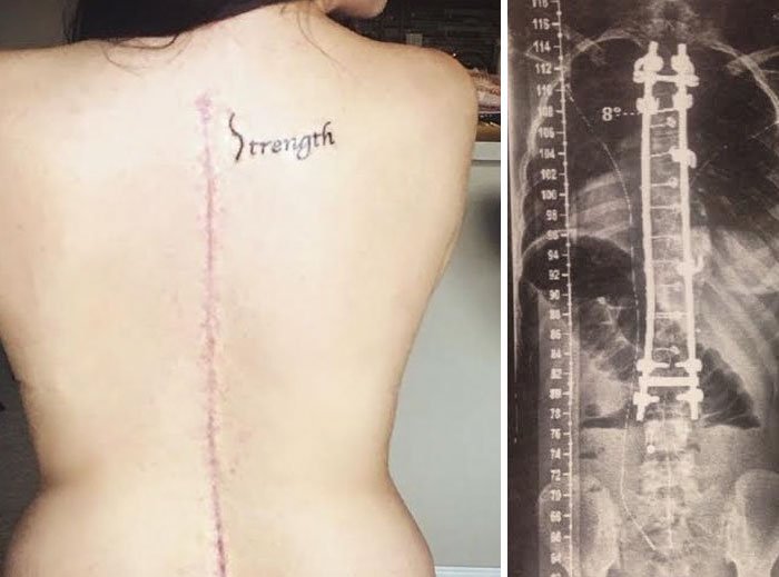 Cool Scar Cover (23 pics)