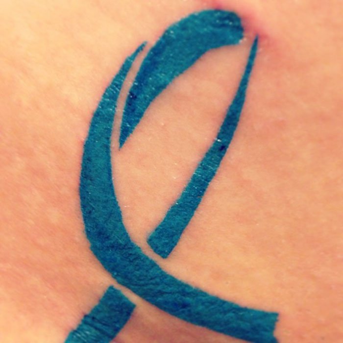 Cool Scar Cover (23 pics)