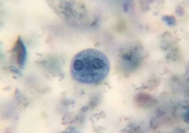 Usual Objects Under The Microscope (20 pics)