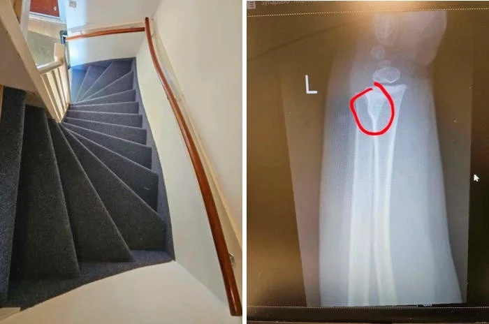 Dangerous Stairs (16 pics)