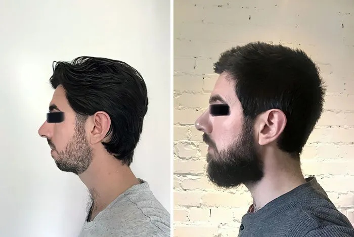 People Who Radically Changed Themselves (21 pics)