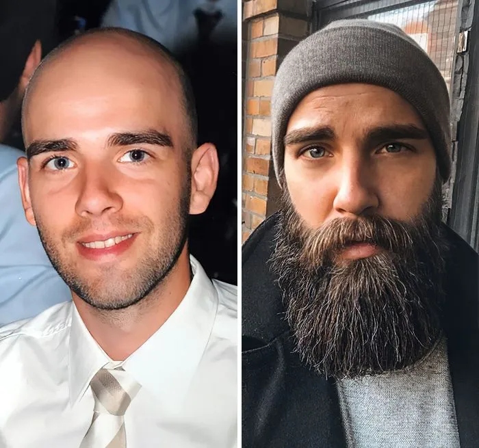 People Who Radically Changed Themselves (21 pics)