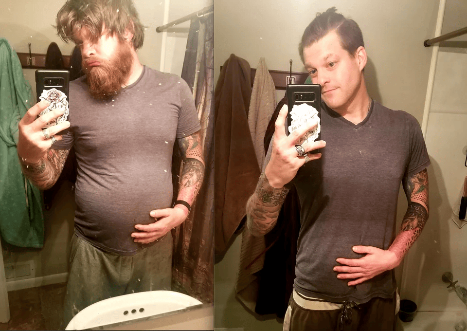 People Who Lose Excess Weight (15 pics)