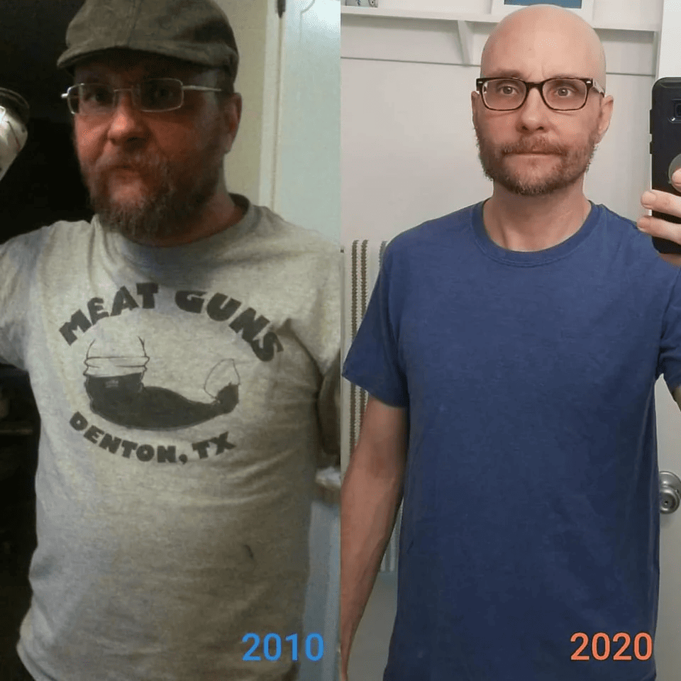 People Who Lose Excess Weight (15 pics)