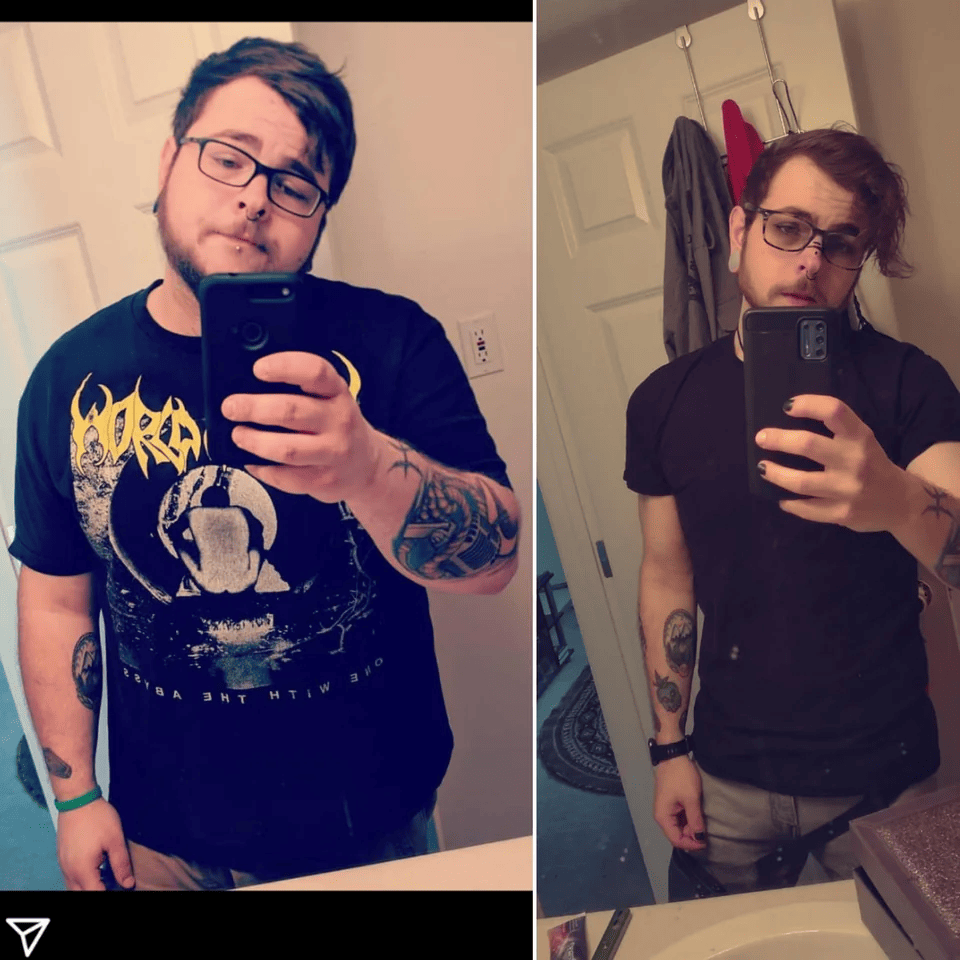 People Who Lose Excess Weight (15 pics)
