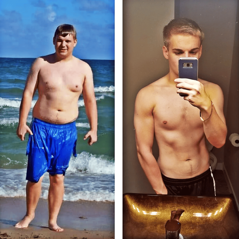 People Who Lose Excess Weight (15 pics)