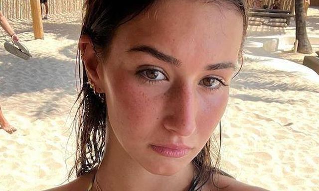 Girls With Freckles (43 pics)