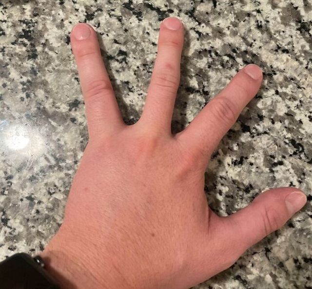 People With Unique Features (27 pics)