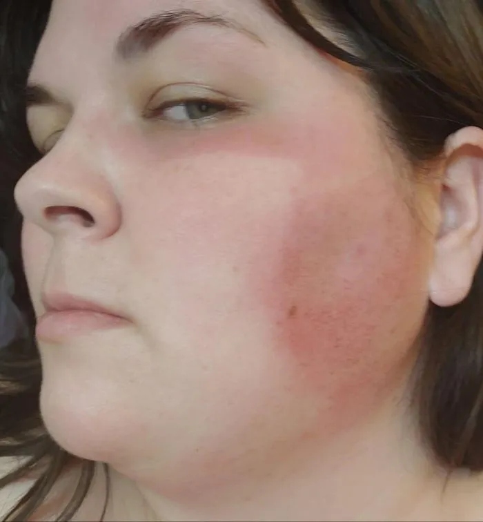 Unsuccessful Tan (18 pics)