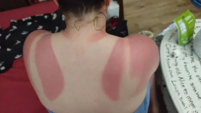 Unsuccessful Tan (18 pics)
