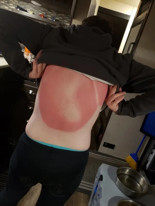 Unsuccessful Tan (18 pics)