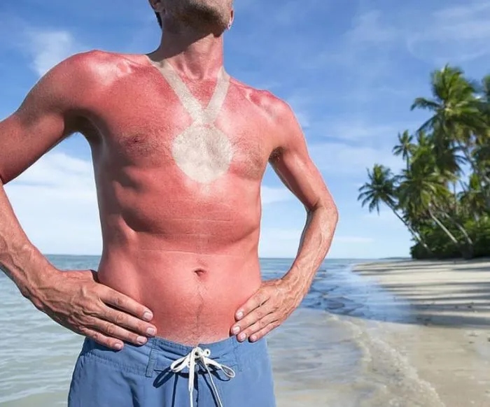 Unsuccessful Tan (18 pics)