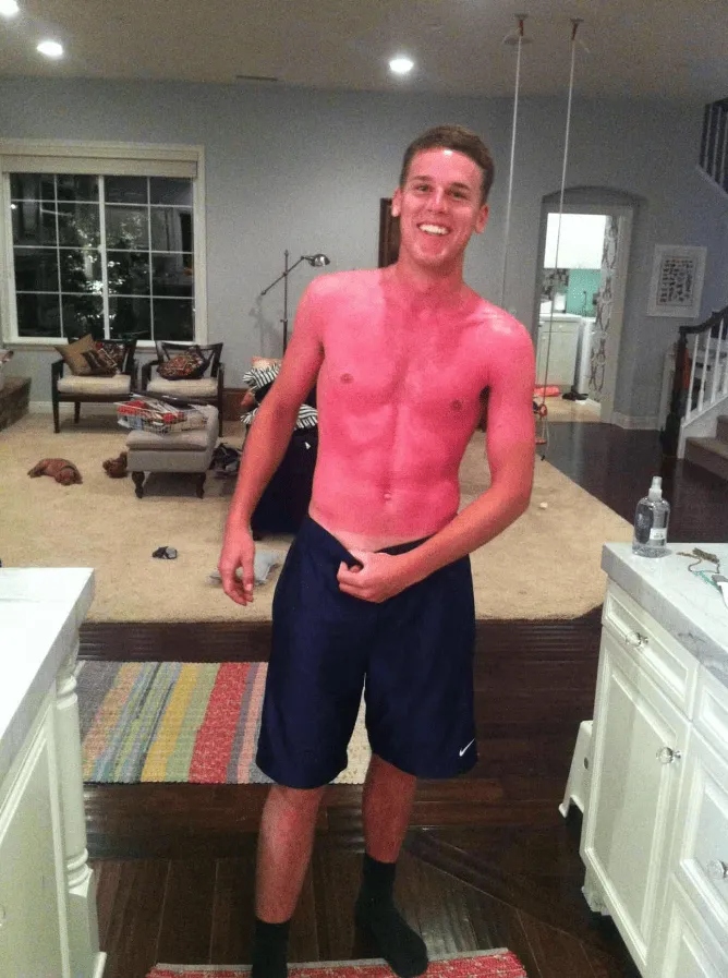 Unsuccessful Tan (18 pics)