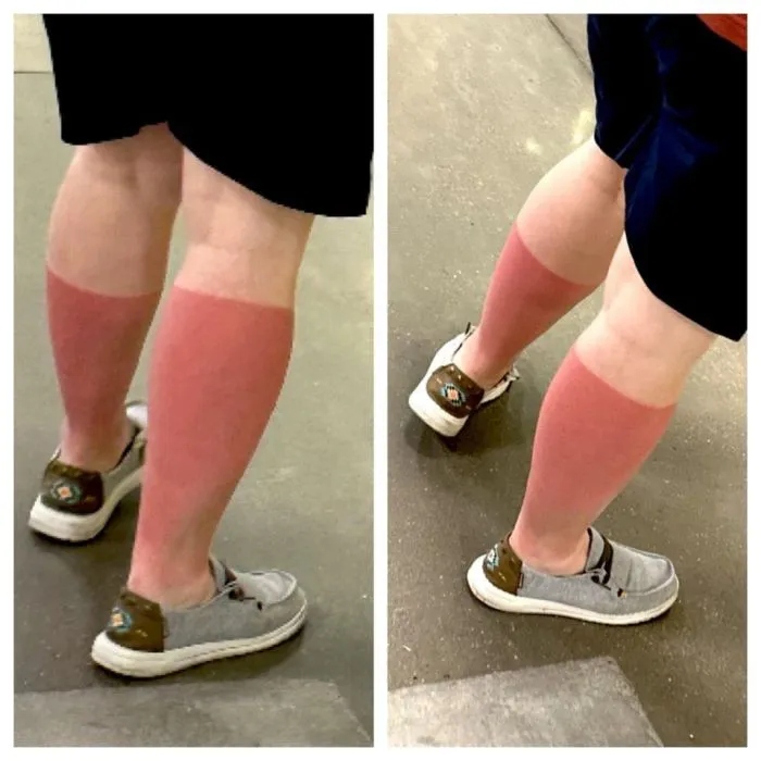 Unsuccessful Tan (18 pics)