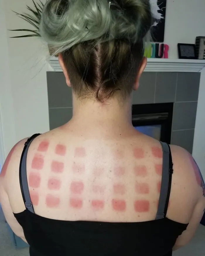 Unsuccessful Tan (18 pics)