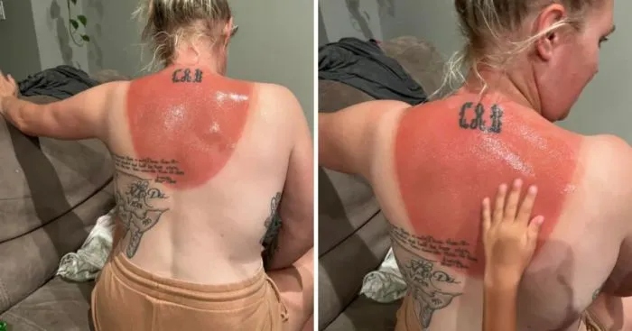 Unsuccessful Tan (18 pics)