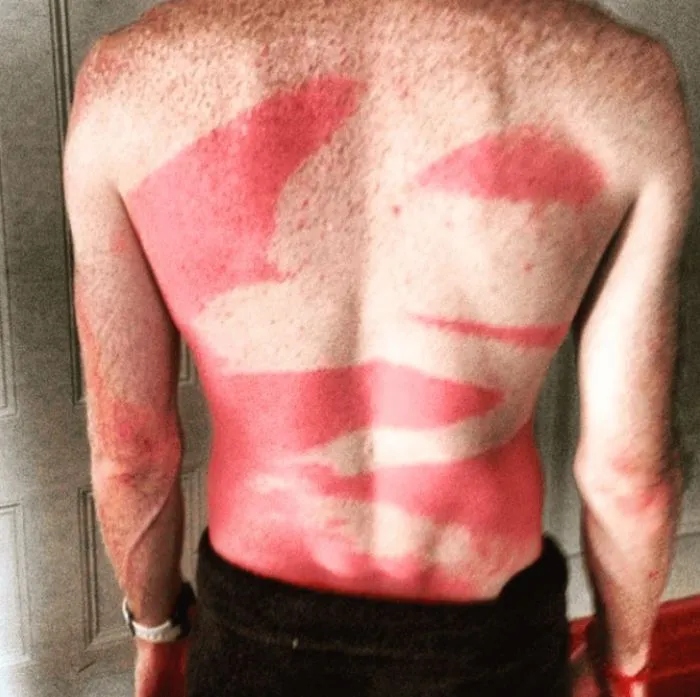 Unsuccessful Tan (18 pics)