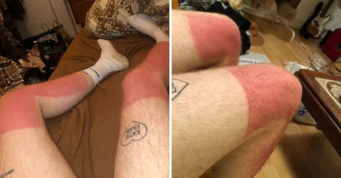 Unsuccessful Tan (18 pics)