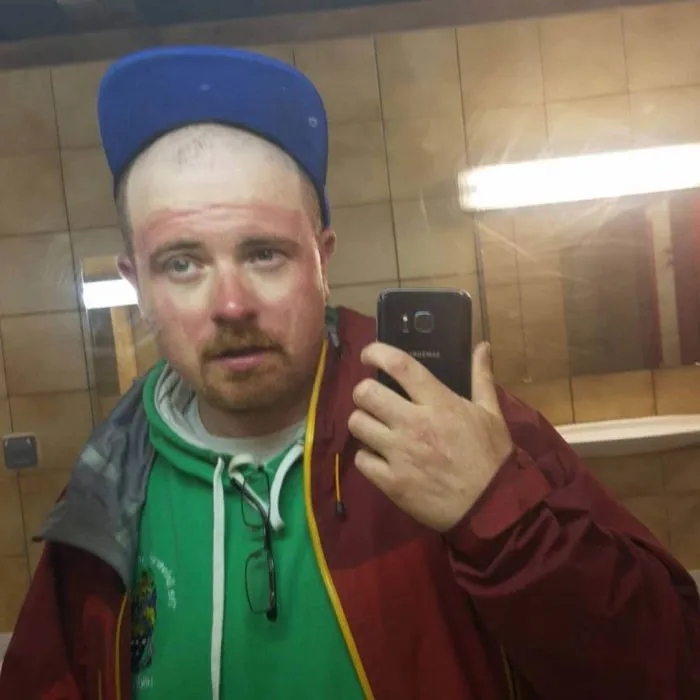 Unsuccessful Tan (18 pics)