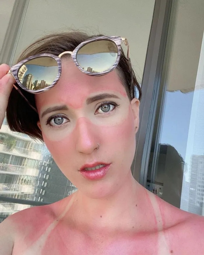 Unsuccessful Tan (18 pics)