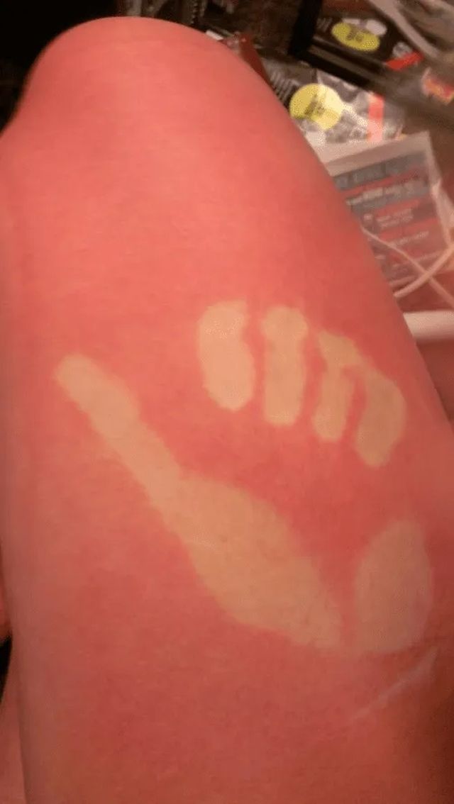 Unsuccessful Tan (18 pics)