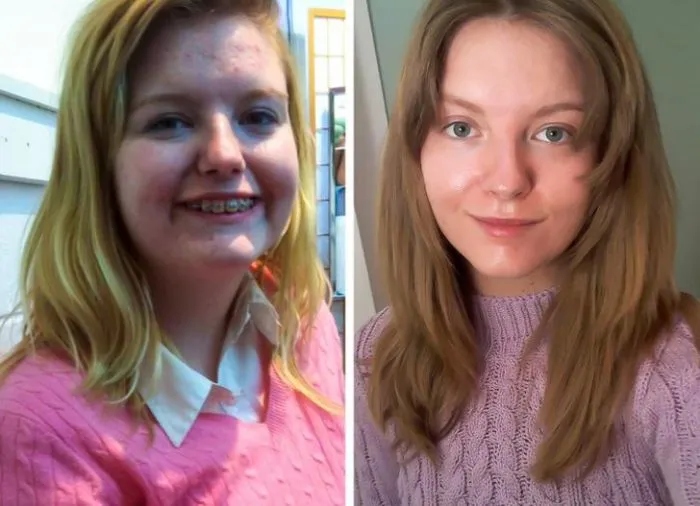 People Who Radically Changed Themselves (17 pics)