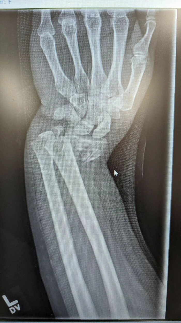 Bad Days Happen (25 pics) Bad Days Happen (25 pics)