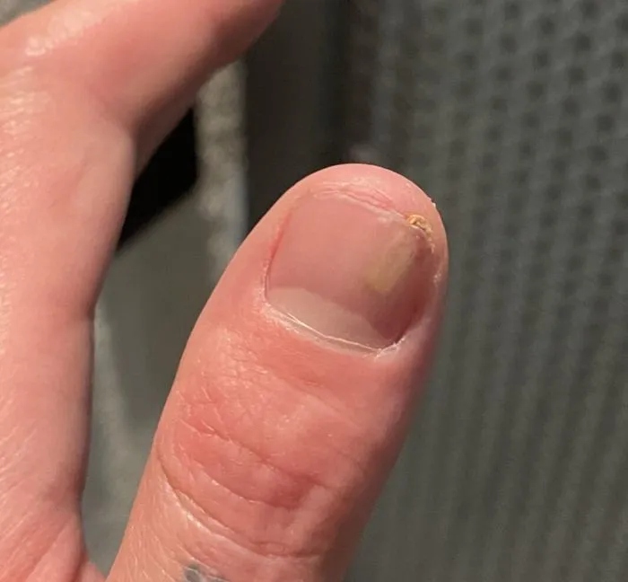 Unfortunate Situations (18 pics)