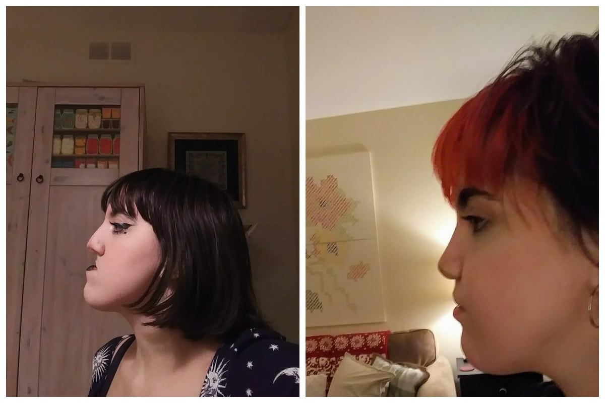 Before And After Photos (23 pics)