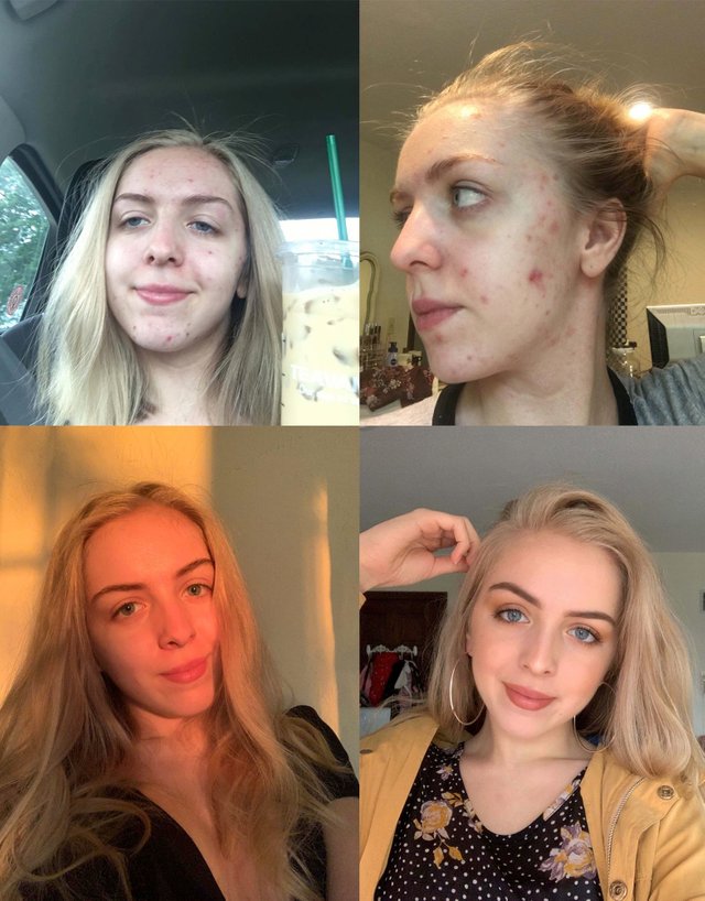 People Who Radically Changed Themselves (23 pics) People Who Radically Changed Themselves (23 pics)