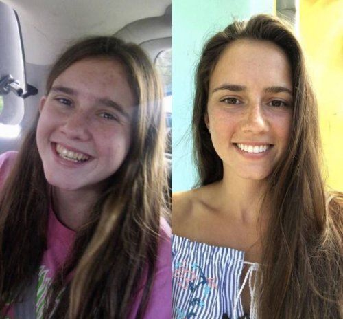 People Who Radically Changed Themselves (23 pics) People Who Radically Changed Themselves (23 pics)