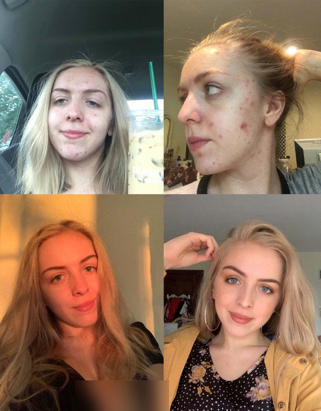 People Who Radically Changed Themselves (23 pics)