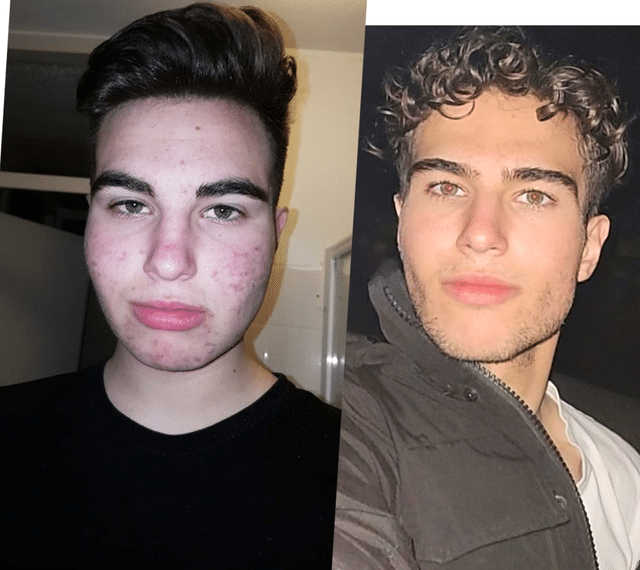 People Who Radically Changed Themselves (21 pics)