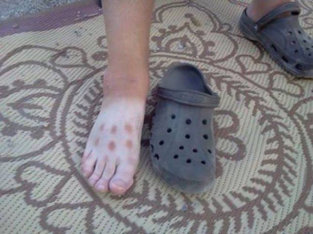 Unfortunate Situations (21 pics)