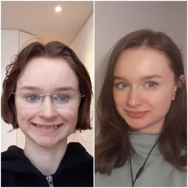 People Who Radically Changed Themselves (20 pics) People Who Radically Changed Themselves (20 pics)