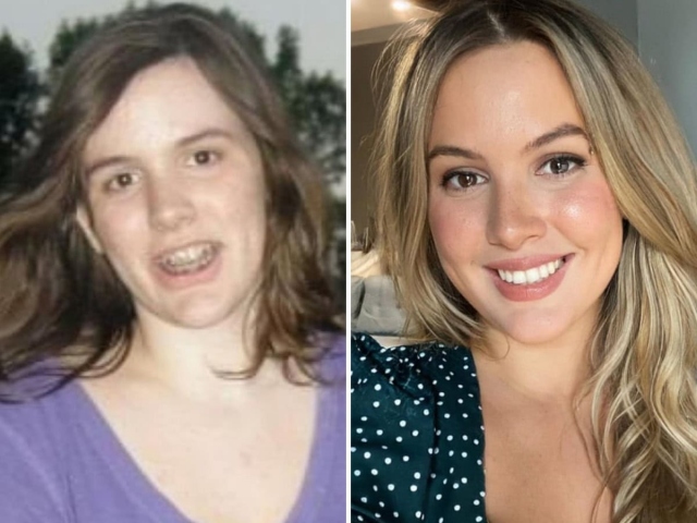 People Who Radically Changed Themselves (18 pics)