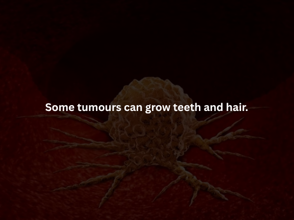 Creepy Facts (14 pics)