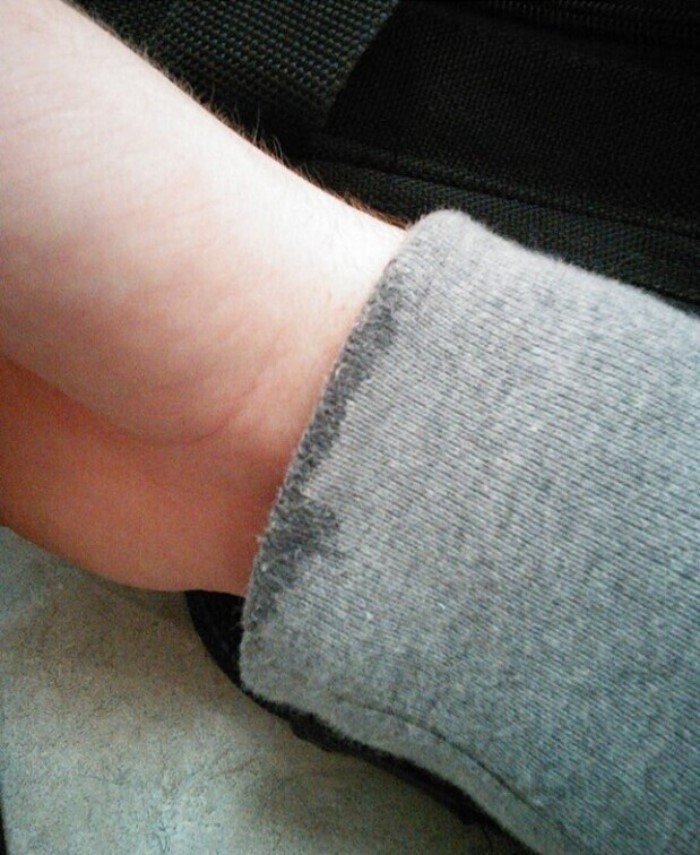 Annoying Situations (23 pics)