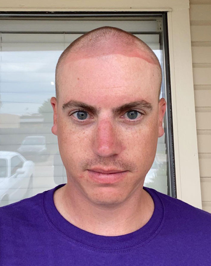 Failed Tanning (25 pics)