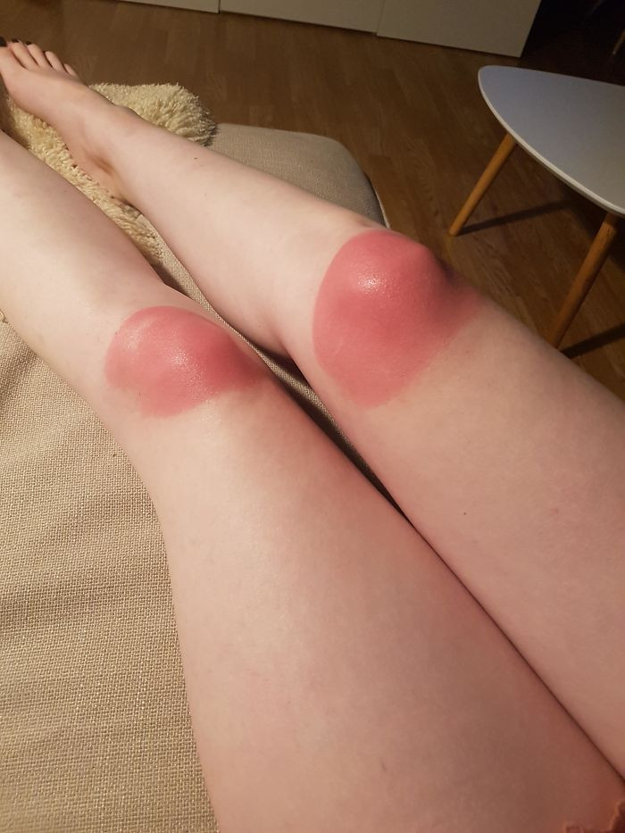 Failed Tanning (25 pics)