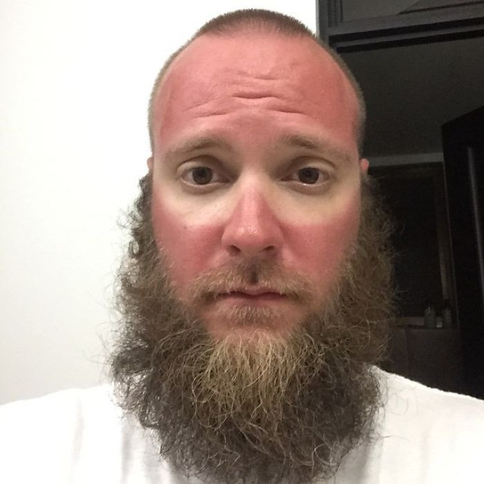 Failed Tanning (25 pics)