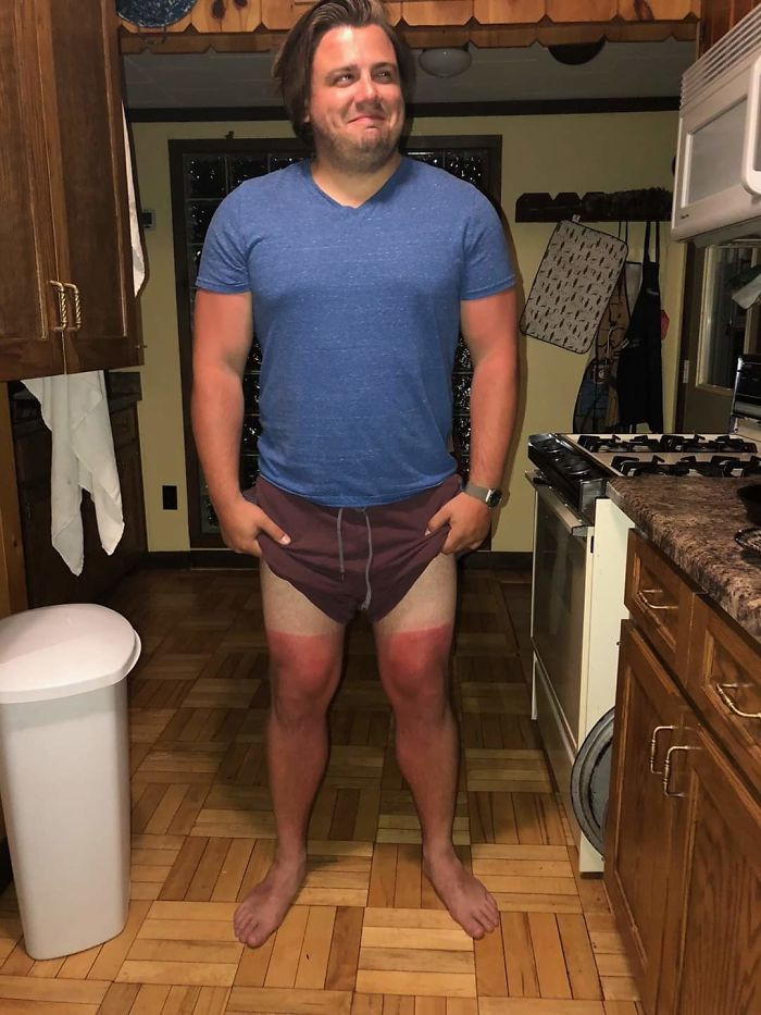 Failed Tanning (25 pics)