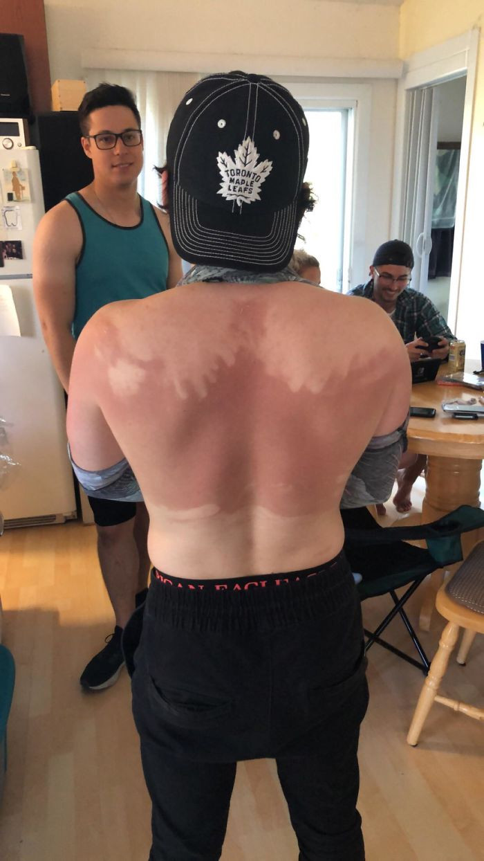 Failed Tanning (25 pics)
