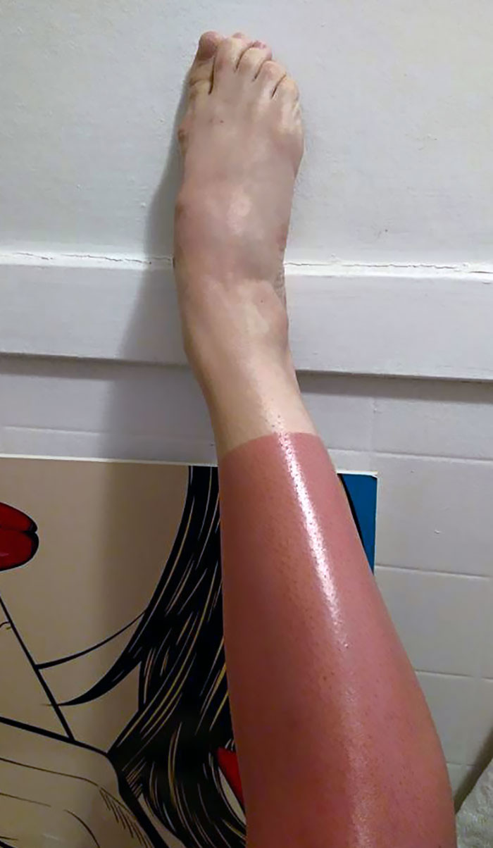 Failed Tanning (25 pics)