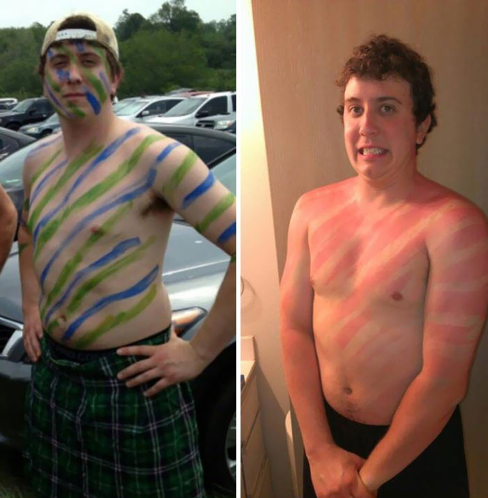 Failed Tanning (25 pics)