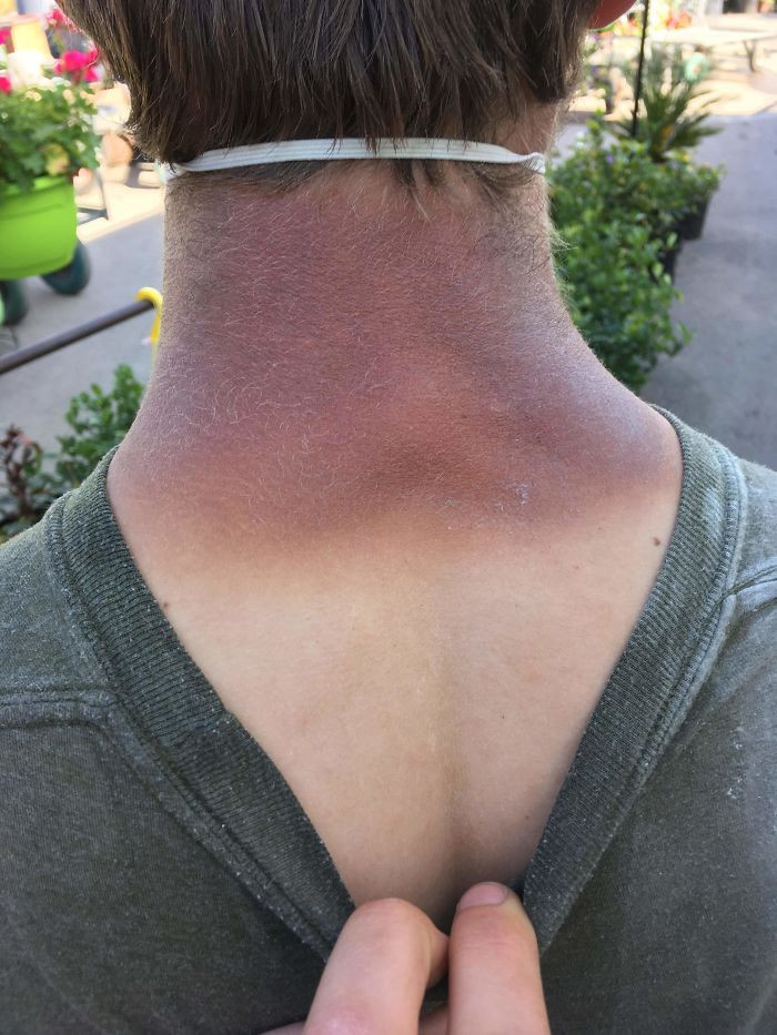 Failed Tanning (25 pics)