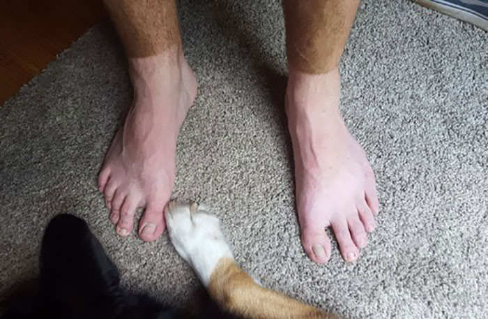Failed Tanning (25 pics)